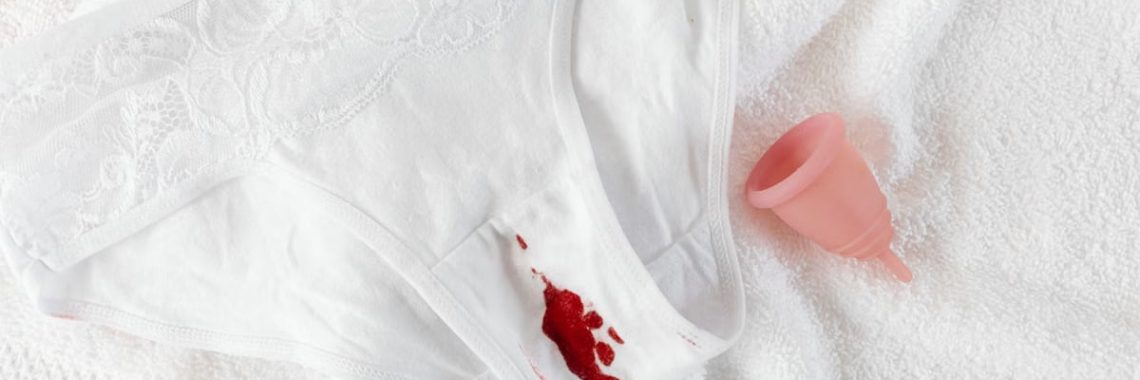 A menstrual cup alongside stained underwear on a clean towel, symbolizing menstrual health.